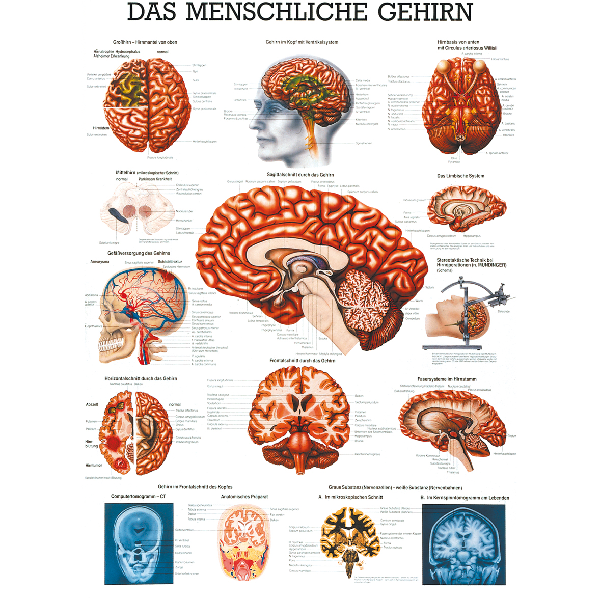 Anatomische Lehrtafel "Das menschliche Gehirn"